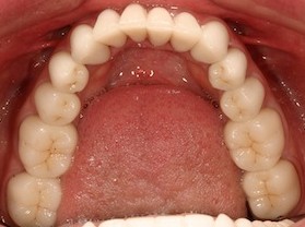 Sample Photos for Online Consultation