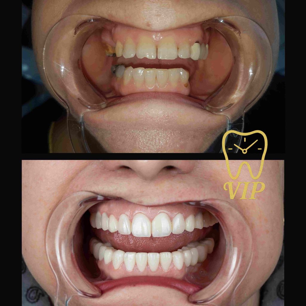 best dentist istanbul