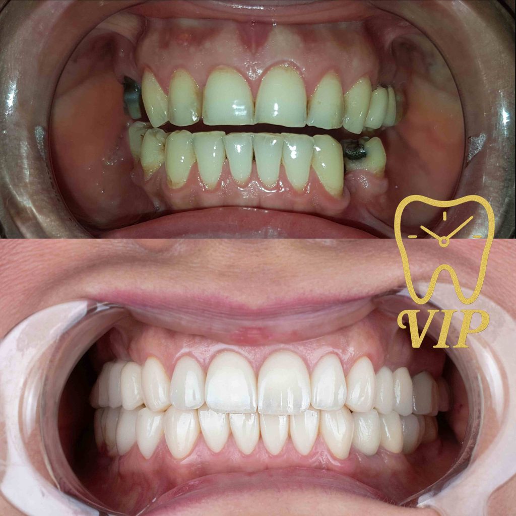 best dental