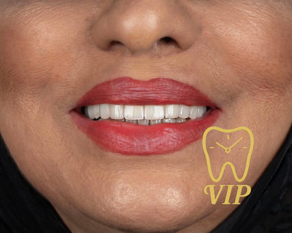 dentis