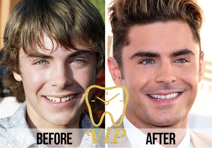 before after celebrities