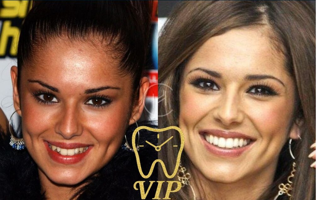 before after celebrities