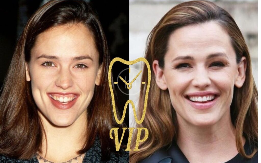 before after celebrities
