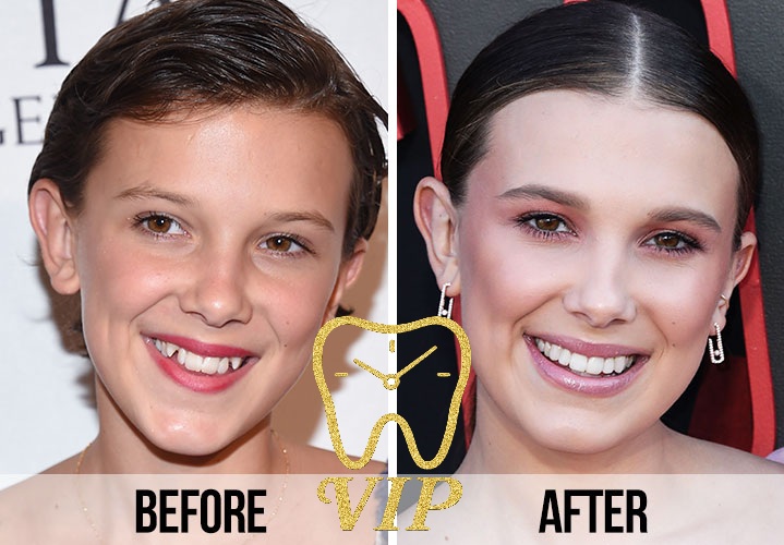 before after celebrities